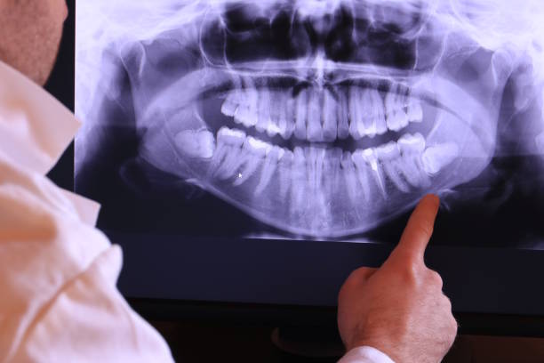 Best Emergency Root Canal Treatment in Shelbyville, KY